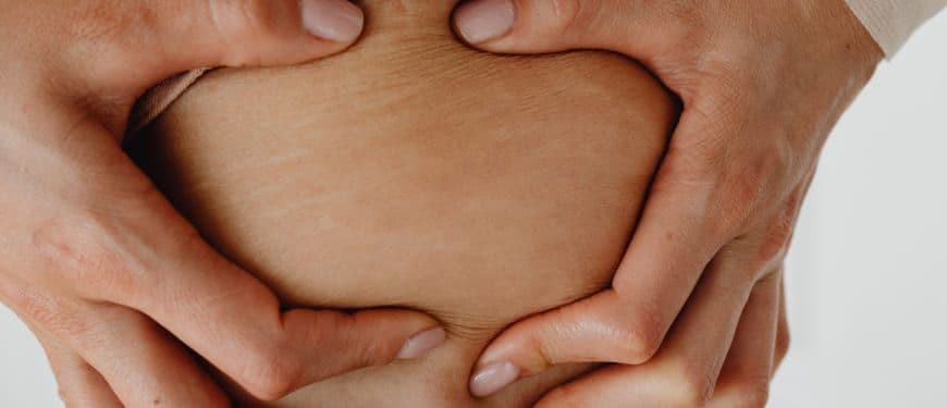 Vergetures : comment les atténuer ?